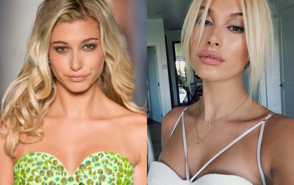 hailey baldwin plastic surgery