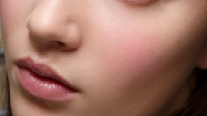 How to Get Rid of Stretch Marks