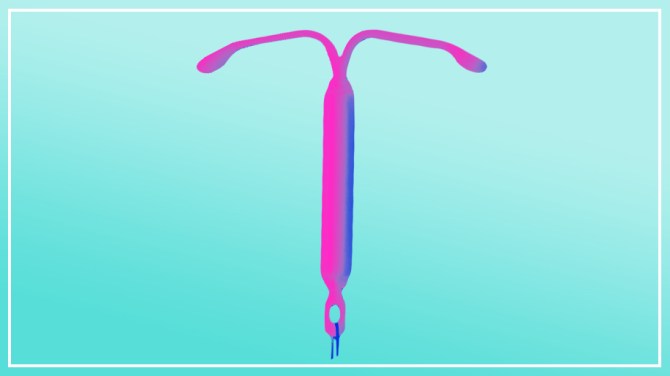 iud review mirena