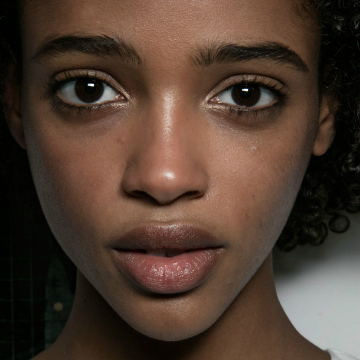 Botox In Your 20s: I'm Only 22, But Botox Boosted My Confidence