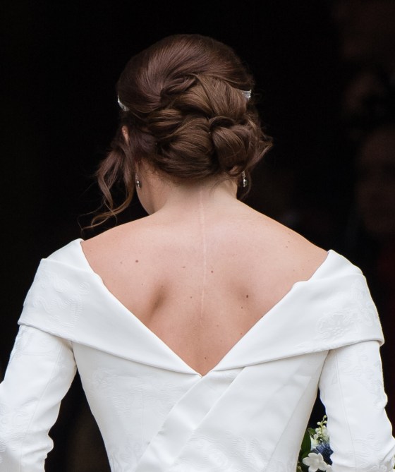 STYLECASTER | Celebrity Scars You Never Knew About | Princess Eugenie