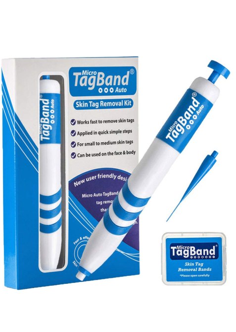 Micro TagBand Skin Tag Remover Device