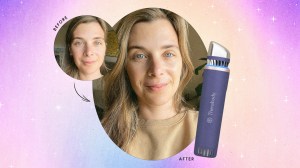 Before and after photos of Jessie using the TheraFace Depuffing Wand